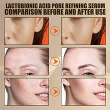 Load image into Gallery viewer, Eelhoe Lactobionic Acid Pore Shrink Face Serum Skin Repair