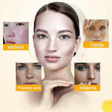 Load image into Gallery viewer, Kojic Acid Powder Whitening Cream