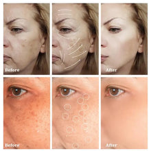 Load image into Gallery viewer, Kojic Acid Serum Strong Brightening Whitening Cream Spots