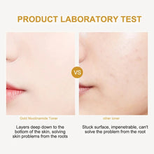 Load image into Gallery viewer, 24K Gold Nicotinamide Toner Moisturize Oil Control Shrink