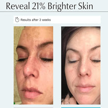 Load image into Gallery viewer, Kojic Acid Serum Strong Brightening Whitening Cream Spots