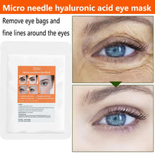 Load image into Gallery viewer, Micro-needle Under Eye Patch for Wrinkles Fine Lines Removal