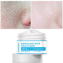 Load image into Gallery viewer, Hyaluronic acid cream to lighten acne marks skin care  firming skin