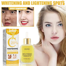 Load image into Gallery viewer, Dark Spot Remover For Face Sun Melasma Freckles Pigment Age Spots