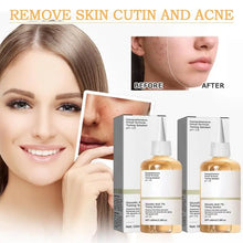 Load image into Gallery viewer, Glycolic Acid Toning Solution Glycolic Acid 7% Facial Toner