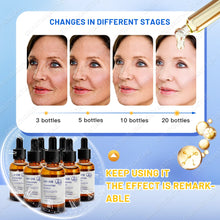 Load image into Gallery viewer, Anti-Wrinkle Anti-Aging Face Serum Lifting Firming Skin Remove Facial