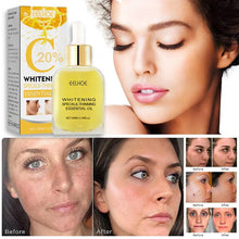 Load image into Gallery viewer, Dark Spot Remover For Face Sun Melasma Freckles Pigment Age Spots