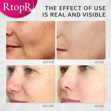 Load image into Gallery viewer, Mango Whitening Face Cream Moisturizing Removing Yellowing