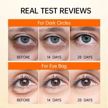 Load image into Gallery viewer, Micro-needle Under Eye Patch for Wrinkles Fine Lines Removal