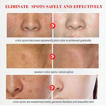 Load image into Gallery viewer, Kojic Acid Powder Whitening Cream