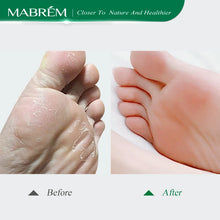 Load image into Gallery viewer, Foot Treatment Cream Whitening Anti-cracking Moisturizing Foot