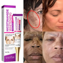 Load image into Gallery viewer, Niacinamide Whitening Freckle Cream Immediately Effectively Removes