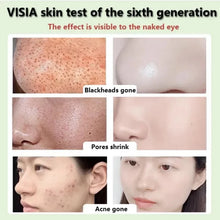 Load image into Gallery viewer, Green Tea Cleansing Stick Face Clean Mask Remove Acne Blackhead Dark