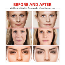 Load image into Gallery viewer, Face Cream Collagen Hyaluronic Acid Skin Care Removal Wrinkle