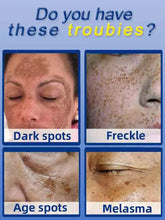 Load image into Gallery viewer, Dark Spot Remover cream for Face Removing Freckle Melasma