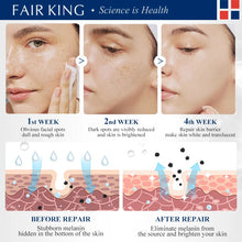 Load image into Gallery viewer, Dark Spot Corrector Skin Whitening Fade Cream Lightening Blemish