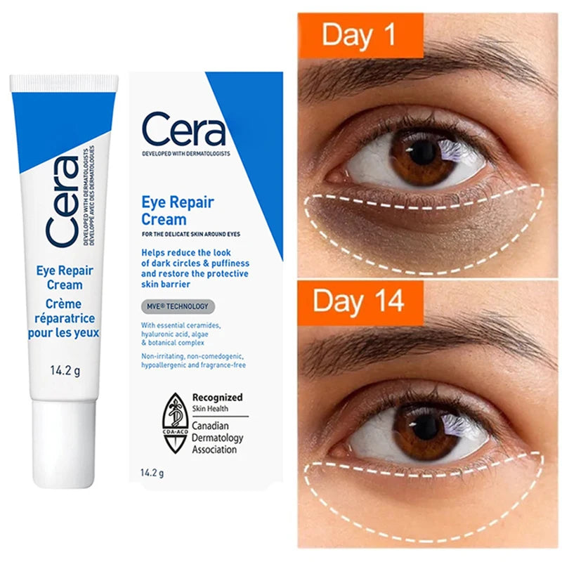 Ceramide Eye Cream Repair Skin Barrier For Dark Circles Under Eyes