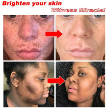 Load image into Gallery viewer, Niacinamide Whitening Freckle Cream Immediately Effectively Removes