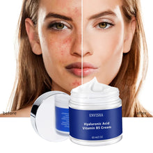 Load image into Gallery viewer, Face Skin Care Hyaluronic Acid &amp; Vitamin B5 Cream Anti-Wrinkle Aging