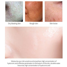 Load image into Gallery viewer, Hyaluronic acid cream to lighten acne marks skin care  firming skin