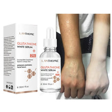 Load image into Gallery viewer, Glutathione Whitening Serum Kit Fade Black Dark Spots