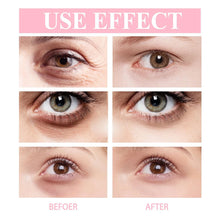 Load image into Gallery viewer, Eye Cream Wrinkle Removing Dark Circles Lightening