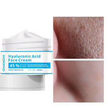 Load image into Gallery viewer, Hyaluronic acid cream to lighten acne marks skin care  firming skin