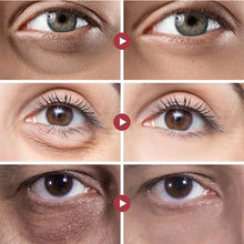 Load image into Gallery viewer, Micro-needle Under Eye Patch for Wrinkles Fine Lines Removal