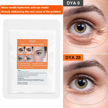 Load image into Gallery viewer, Micro-needle Under Eye Patch for Wrinkles Fine Lines Removal