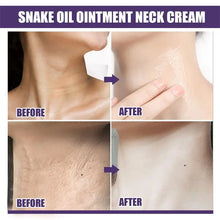 Load image into Gallery viewer, Neck Anti-Wrinkle Cream Rejuvenation Tightening Skin Whitening