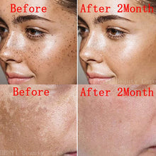 Load image into Gallery viewer, Face Cream Skin Whitening