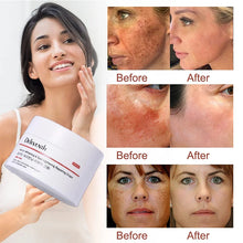 Load image into Gallery viewer, Face Cream Skin Whitening