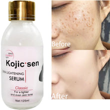 Load image into Gallery viewer, Kojic Acid Serum Strong Brightening Whitening Cream Spots