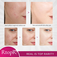Load image into Gallery viewer, Mango Whitening Face Cream Moisturizing Removing Yellowing
