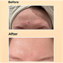 Load image into Gallery viewer, All In One Face Cream Essence Moisturizing