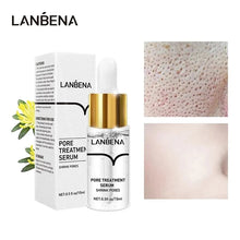 Load image into Gallery viewer, Hyaluronic Acid Serum Blackhead Removing Moisturizing Acne