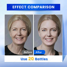 Load image into Gallery viewer, Anti-Wrinkle Anti-Aging Face Serum Lifting Firming Skin Remove Facial
