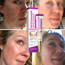 Load image into Gallery viewer, Niacinamide Whitening Freckle Cream Immediately Effectively Removes