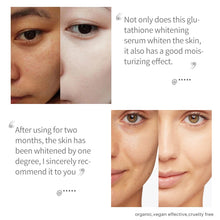 Load image into Gallery viewer, Glutathione Whitening Serum Kit Fade Black Dark Spots