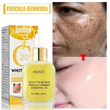 Load image into Gallery viewer, Dark Spot Remover For Face Sun Melasma Freckles Pigment Age Spots