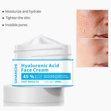 Load image into Gallery viewer, Hyaluronic acid cream to lighten acne marks skin care  firming skin