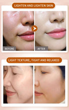 Load image into Gallery viewer, 100Pcs Hyaluronic Acid Capsules Serum Spot Acne Remover Whitening