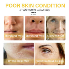 Load image into Gallery viewer, 24K Gold Face Serum Set Hyaluronic Acid Acne Serum Moisturizer Essence