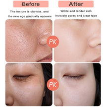 Load image into Gallery viewer, 24K Gold Face Serum Set Hyaluronic Acid Acne Serum Moisturizer Essence