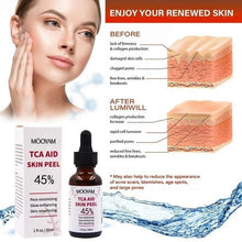 Load image into Gallery viewer, 45%Tca Aid Skin Peel Pore Minimizing Spots Remove Anti Wrinkle Skin