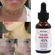 Load image into Gallery viewer, 45%Tca Aid Skin Peel Pore Minimizing Spots Remove Anti Wrinkle Skin