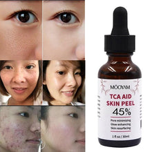 Load image into Gallery viewer, 45%Tca Aid Skin Peel Pore Minimizing Spots Remove Anti Wrinkle Skin