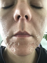 Load image into Gallery viewer, 45%Tca Aid Skin Peel Pore Minimizing Spots Remove Anti Wrinkle Skin