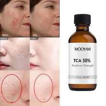 Load image into Gallery viewer, 50%TCA Chemical Peel Anti Aging Anti Wrinkle Peeling Serum for Repair