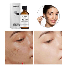 Load image into Gallery viewer, 50%TCA Chemical Peel Anti Aging Anti Wrinkle Peeling Serum for Repair